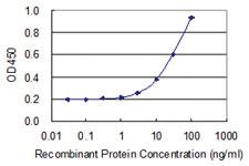 Anti-C5AR1 Mouse Monoclonal Antibody [clone: 4E2]