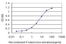 Anti-MAP2K5 Mouse Monoclonal Antibody [clone: 3E10]