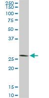 Anti-CNOT7 Mouse Monoclonal Antibody [clone: 2F6]