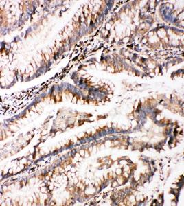 Anti-Bag3 Rabbit Polyclonal Antibody