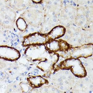 Immunohistochemistry analysis of paraffin-embedded rat kidney using Anti-MT-ND5 Antibody (A93006) at a dilution of 1:100 (40x lens). Perform microwave antigen retrieval with 10 mM PBS buffer pH 7.2 before commencing with IHC staining protocol.