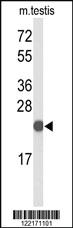 Anti-FGF10 Rabbit Polyclonal Antibody