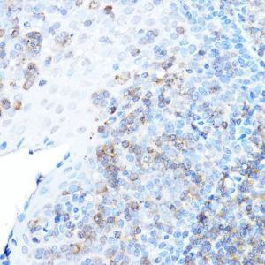 Immunohistochemistry analysis of paraffin-embedded human tonsil using Anti-ULBP1 Antibody (A8629) at a dilution of 1:500 (40x lens) Perform high pressure antigen retrieval with 10 mM citrate buffer pH 60 before commencing with IHC staining protocol