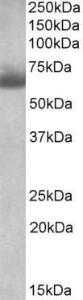 Anti-BBS4 antibody