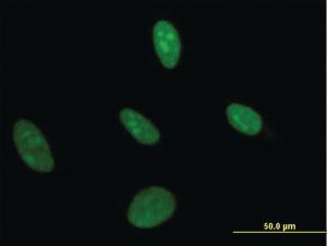 Anti-UMPS Mouse Monoclonal Antibody [clone: 2F5]