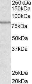 Anti-ABCB5 Goat Polyclonal Antibody