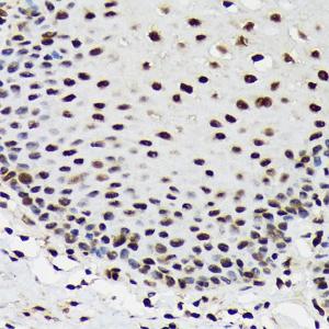 Immunohistochemistry analysis of paraffin-embedded human esophageal using Anti-SF3B3 Antibody [ARC1667] (A309080) at a dilution of 1:100 (40X lens). Perform microwave antigen retrieval with 10 mM Tris/EDTA buffer pH 9.0 before commencing with IHC staining protocol