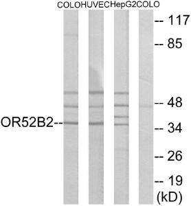 Anti-OR52B2 Rabbit Polyclonal Antibody