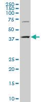 Anti-CMPK2 Mouse Polyclonal Antibody