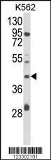 Anti-COQ3 Rabbit Polyclonal Antibody (HRP (Horseradish Peroxidase))