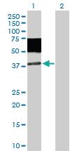 Anti-MICA Rabbit Polyclonal Antibody