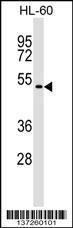 Anti-GSG1 Rabbit Polyclonal Antibody (HRP (Horseradish Peroxidase))