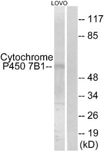 Western blot analysis of lysates from LOVO cells using Anti-Cytochrome P450 7B1 Antibody. The right hand lane represents a negative control, where the antibody is blocked by the immunising peptide.