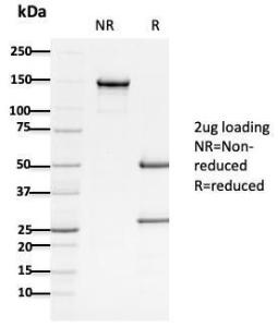 Anti-APC Mouse Monoclonal Antibody [clone: ALi 12-28]