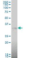 Anti-MAP2K6 Mouse Monoclonal Antibody [clone: 2F2]