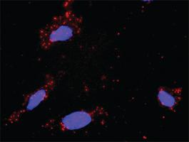 Anti-TGFB1 + DAXX Antibody Pair