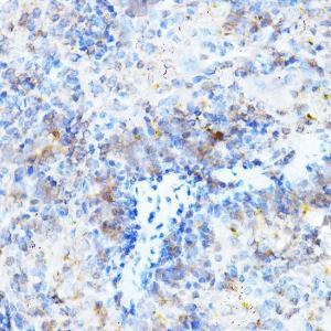 Immunohistochemistry analysis of paraffin-embedded mouse spleen using Anti-ULBP1 Antibody (A8629) at a dilution of 1:500 (40x lens) Perform high pressure antigen retrieval with 10 mM citrate buffer pH 60 before commencing with IHC staining protocol