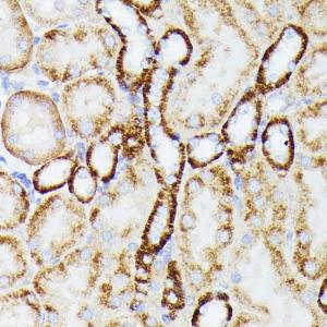 Immunohistochemistry analysis of paraffin-embedded mouse kidney using Anti-MT-ND5 Antibody (A93006) at a dilution of 1:100 (40x lens). Perform microwave antigen retrieval with 10 mM PBS buffer pH 7.2 before commencing with IHC staining protocol.