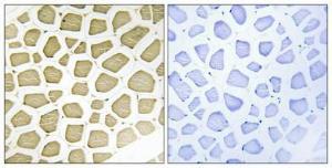 Immunohistochemical analysis of paraffin-embedded human skeletal muscle using Anti-Cytochrome P450 7B1 Antibody 1:100 (4°C overnight). The right hand panel represents a negative control, where the antibody was pre-incubated with the immunising peptide.