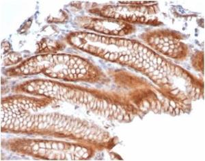 Immunohistochemical analysis of formalin-fixed, paraffin-embedded human kidney tissue using Anti-Reelin Antibody [RELN/4498]. Inset: PBS instead of the primary antibody. Secondary antibody negative control.