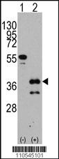 Anti-ZIC4 Rabbit Polyclonal Antibody