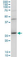 Anti-DNAJB6 Mouse Polyclonal Antibody