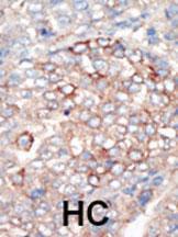 Anti-PI3KR4 Rabbit Polyclonal Antibody (HRP (Horseradish Peroxidase))