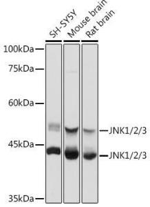 Western blot analysis of extracts of various cell lines, using Anti-JNK1 + JNK2 + JNK3 Antibody (A307842) at 1:1,000 dilution