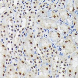 Immunohistochemistry analysis of paraffin-embedded mouse kidney using Anti-SF3B3 Antibody [ARC1667] (A309080) at a dilution of 1:100 (40X lens). Perform microwave antigen retrieval with 10 mM Tris/EDTA buffer pH 9.0 before commencing with IHC staining protocol