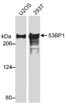 Anti-TP53BP1 Rabbit Polyclonal Antibody