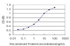 Anti-UMPS Mouse Monoclonal Antibody [clone: 2F5]