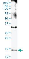 Anti-NPHP1 Polyclonal Antibody Pair