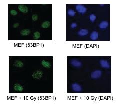 Anti-TP53BP1 Rabbit Polyclonal Antibody