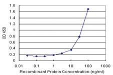 Anti-B2M Antibody Pair