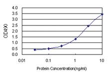 Anti-NR3C1 Antibody Pair