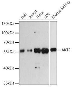 Western blot analysis of extracts of various cell lines, using Anti-AKT2 Antibody (A93007) at 1:3000 dilution