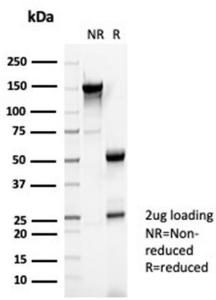 SDS-PAGE analysis of Anti-Reelin Antibody [RELN/4498] under non-reduced and reduced conditions; showing intact IgG and intact heavy and light chains, respectively. SDS-PAGE analysis confirms the integrity and purity of the antibody.