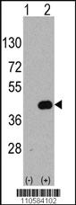 Anti-WIF1 Rabbit Polyclonal Antibody