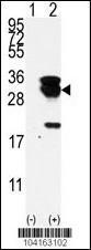 Anti-UBE2S Rabbit Polyclonal Antibody (PE (Phycoerythrin))