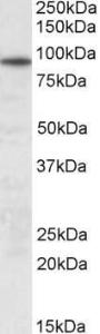 Anti-UNC45B Antibody (A83303) (0.3µg/ml) staining of Human Skeletal Muscle lysate (35µg protein in RIPA buffer). Primary incubation was 1 hour. Detected by chemiluminescence.