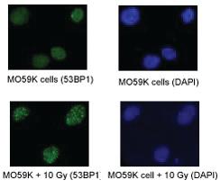 Anti-TP53BP1 Rabbit Polyclonal Antibody