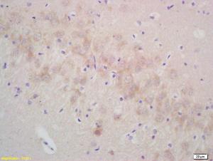 Anti-SNCG Rabbit Polyclonal Antibody