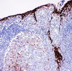 Anti-Cystatin A Rabbit Polyclonal Antibody