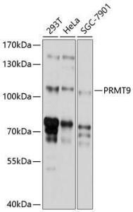 Anti-PRMT10 Antibody (A8632)