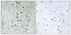 Immunohistochemical analysis of paraffin-embedded human brain using Anti-REXO1 Antibody The right hand panel represents a negative control, where the antibody was pre-incubated with the immunising peptide