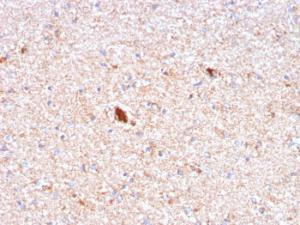 Immunohistochemical analysis of formalin-fixed, paraffin-embedded human brain using Anti-Serum Amyloid P Antibody [APCS/3240]