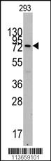 Anti-CDH5 Rabbit Polyclonal Antibody