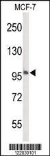 Anti-FANCG Rabbit Polyclonal Antibody