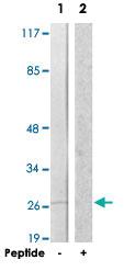 Anti-BRI3BP Rabbit Polyclonal Antibody