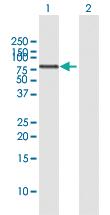 Anti-RIOK2 Rabbit Polyclonal Antibody